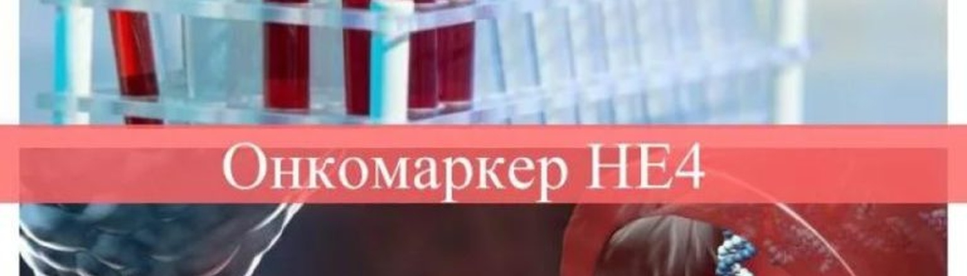 Онкомаркер HE4 – признаки рака яичников у женщин