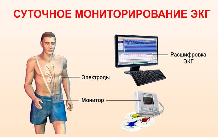 Холтеровское ЭКГ