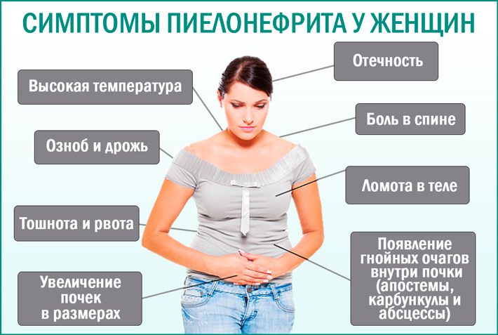 Пиелонефрит, симптомы у женщин