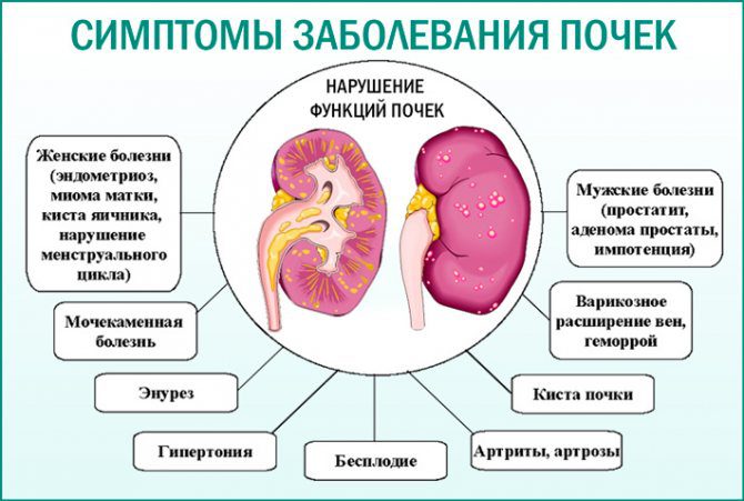 Симптомы болезней почек