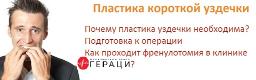 Пластика уздечки полового члена