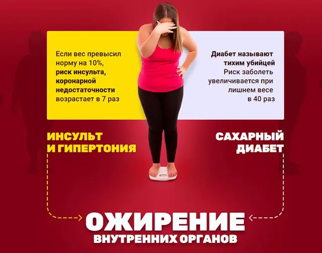 Ожирение Ростов-на-Дону