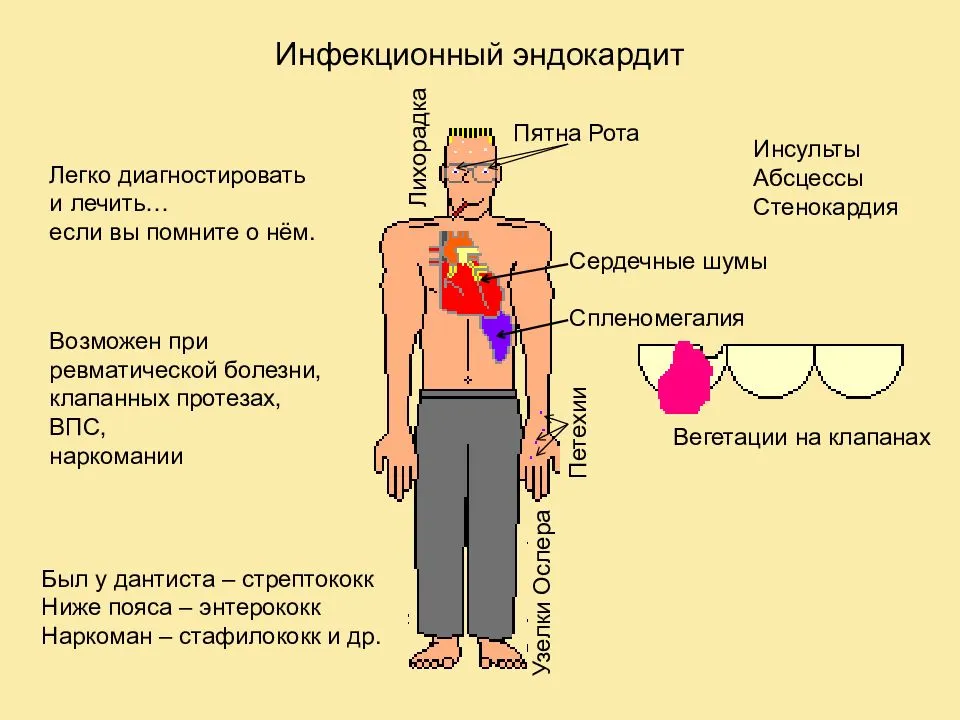 Болезнь с поражением сердца