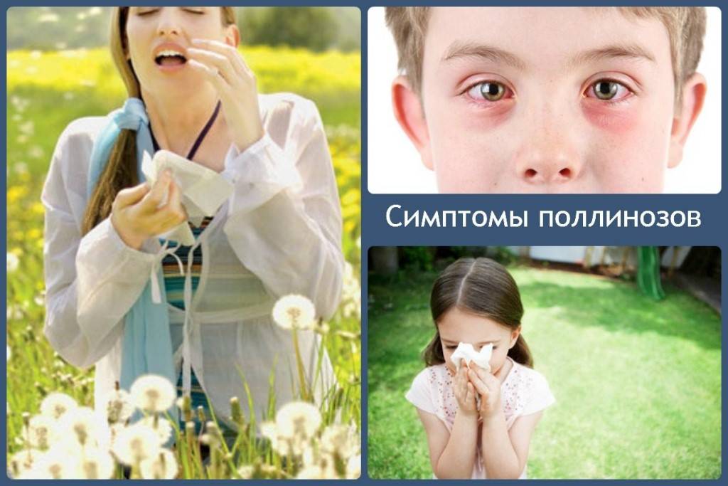 Профилактика поллиноза