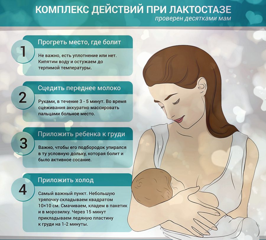 Лактостаз лечение у кормящей