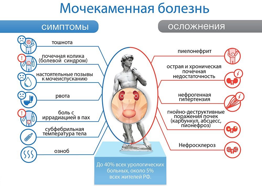Анализ состава мочевого камня