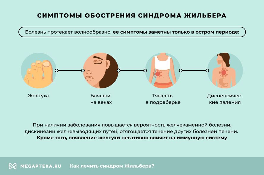 Лечение Жильбера