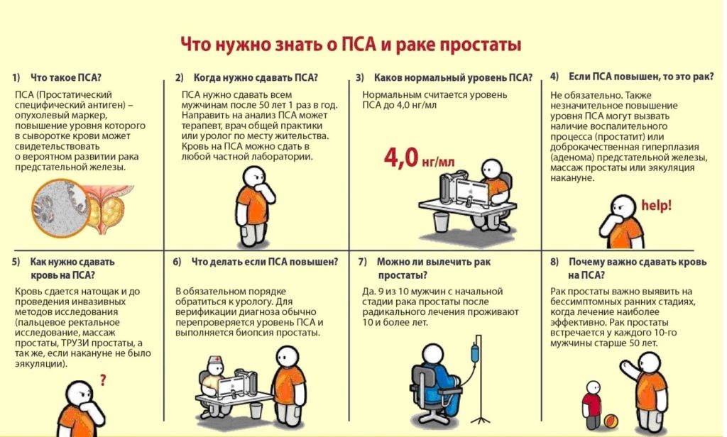 Анализа на ПСА - цена