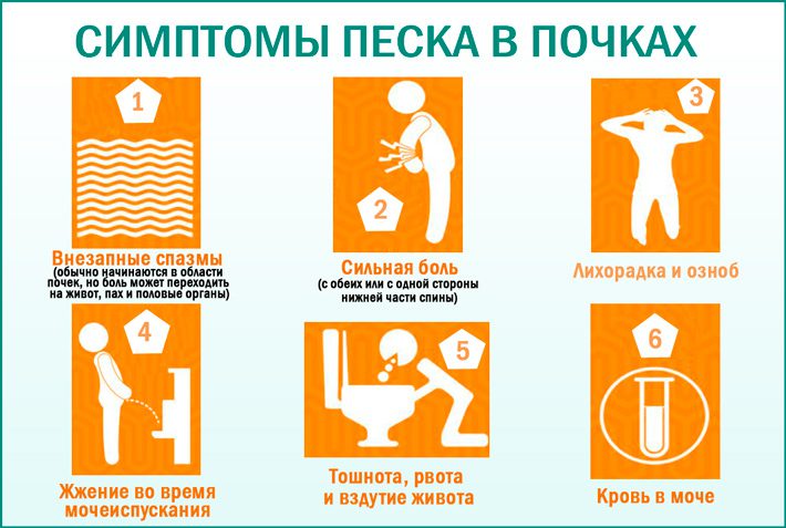 Анализ на ураты в моче