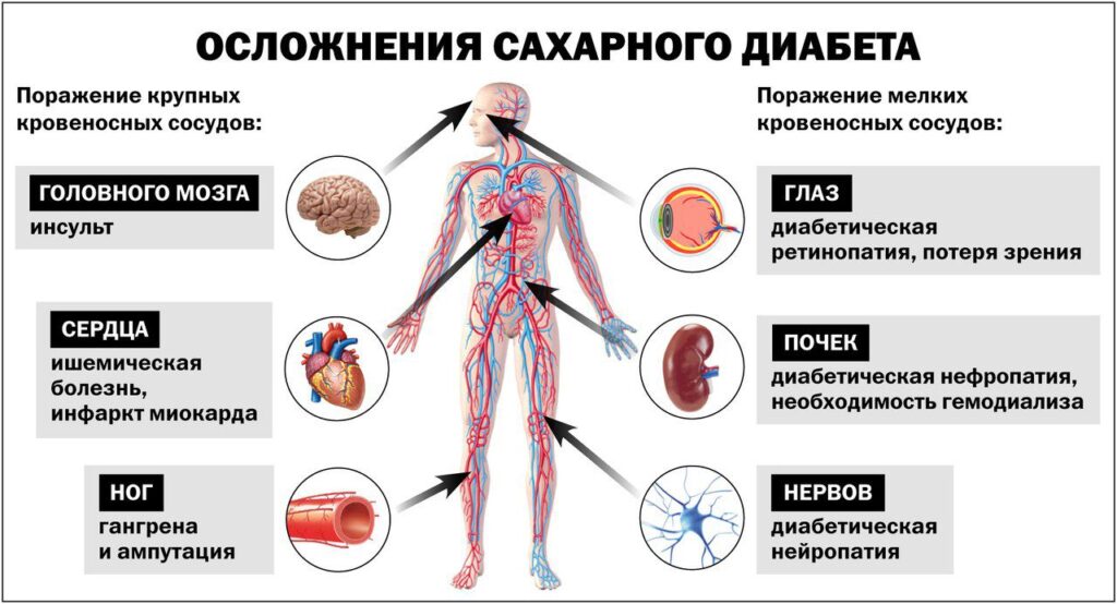 сахарный диабет причина ССЗ