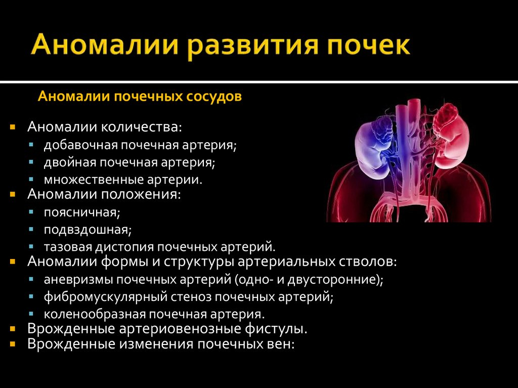 Аномалии почек